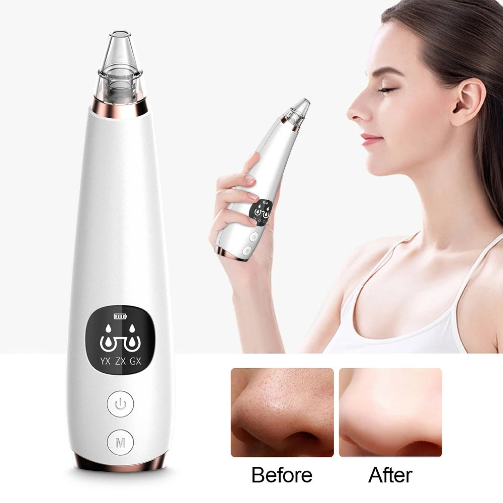 New electric blackhead removal and pore cleaning for blackheads